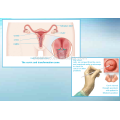Amostragem Oral Masculina e Feminina e Amostragem Nasal e Infecção da Uretra Amostragem Amostra de Flocked Swab